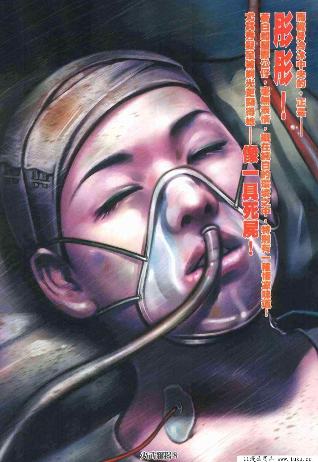 第395话
