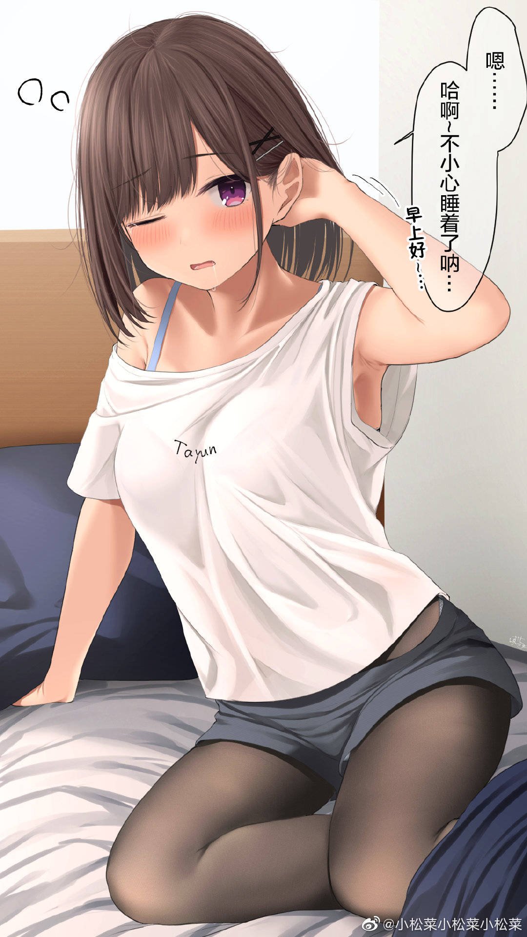 第148话