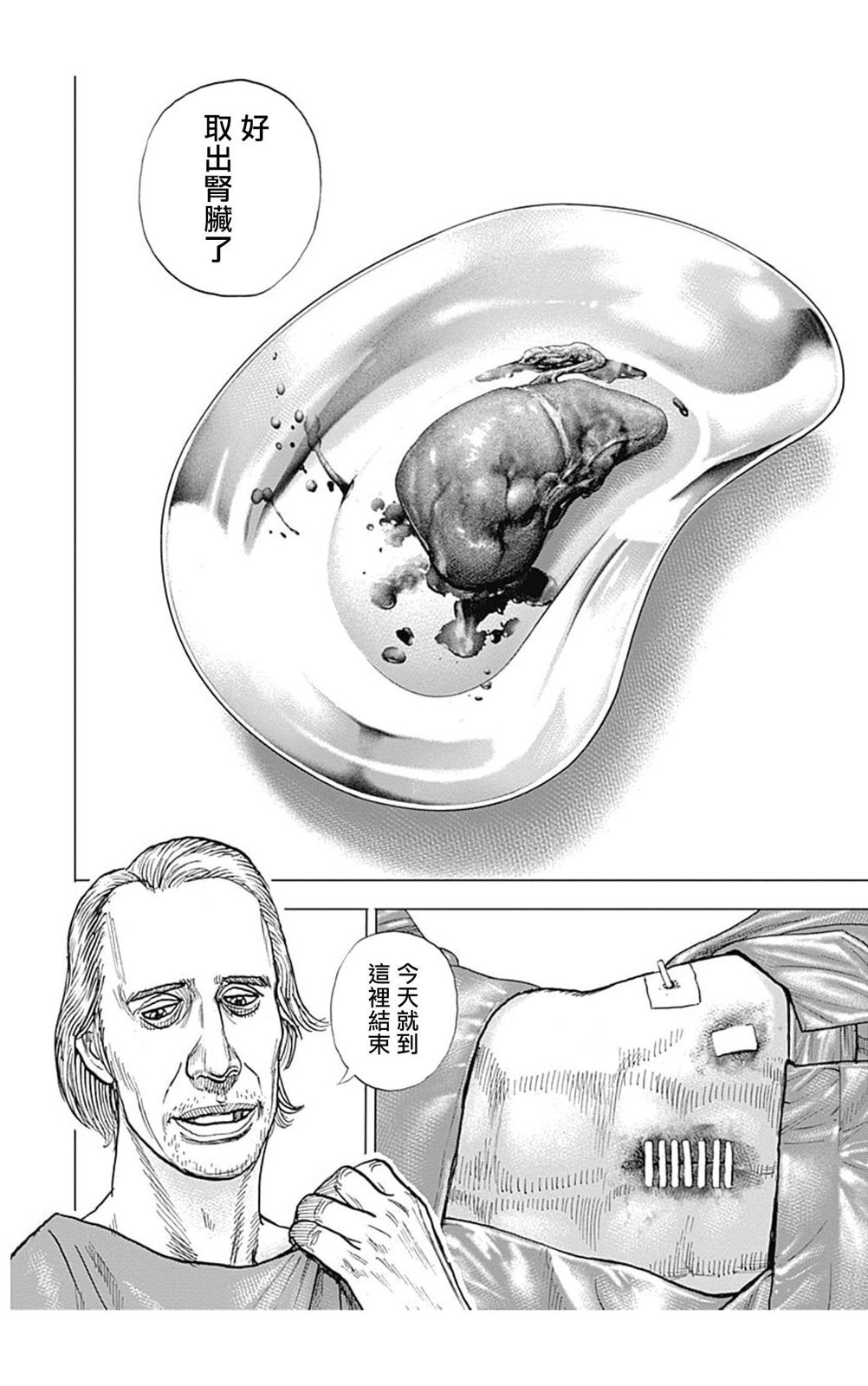 第146话