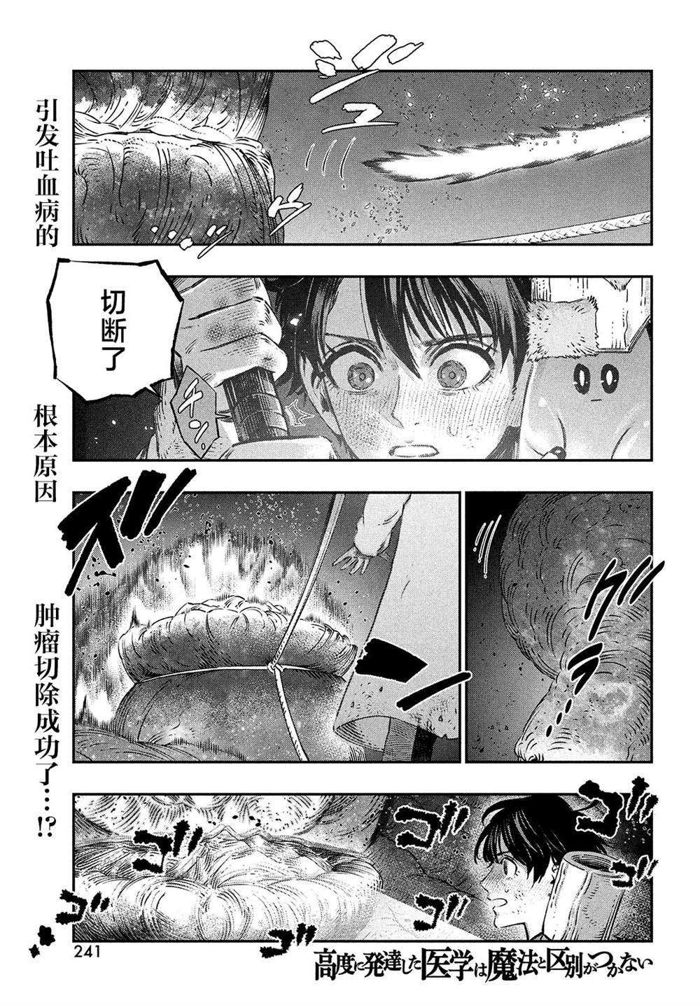 第9话
