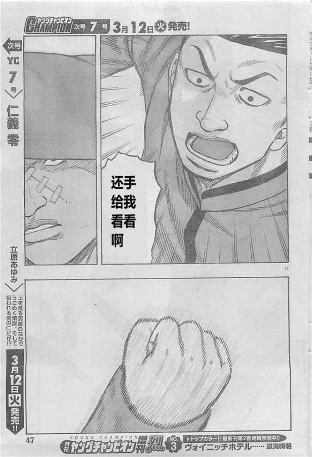 第20话