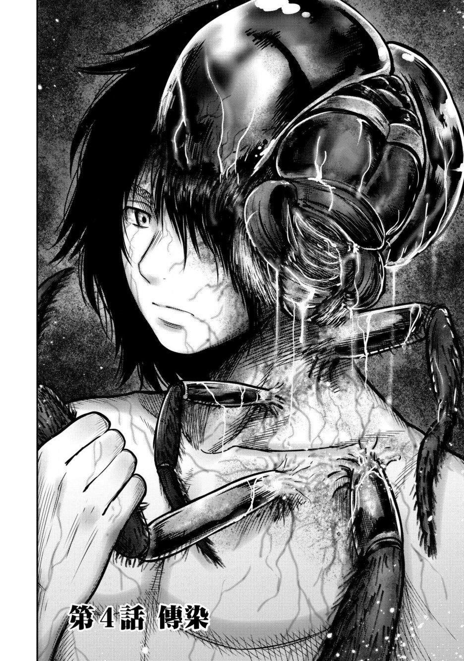 第4话 传染