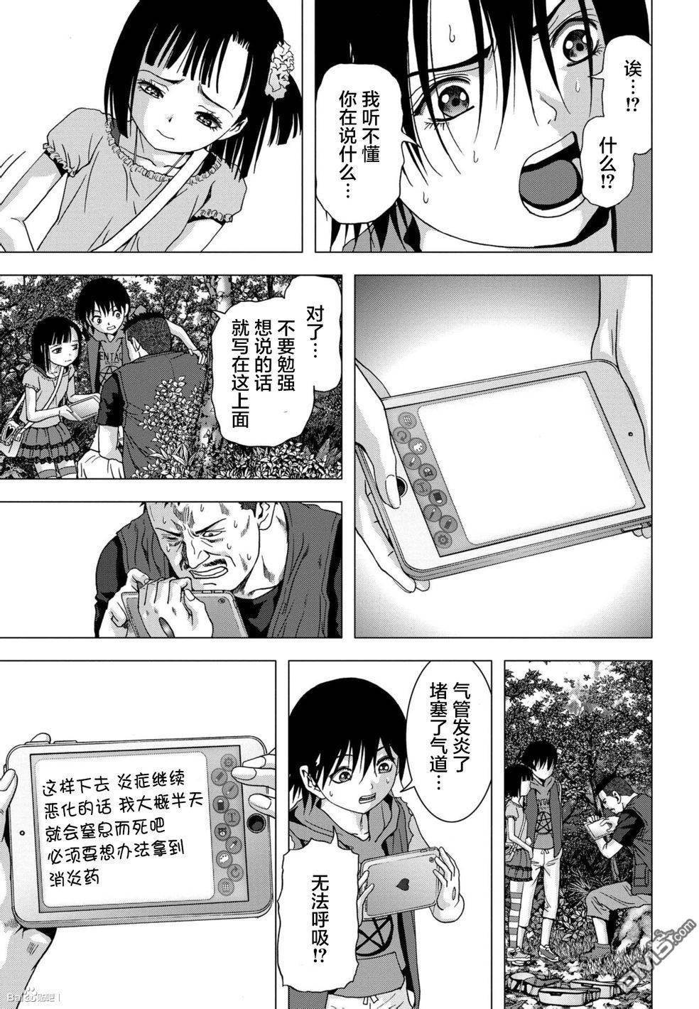 第87话