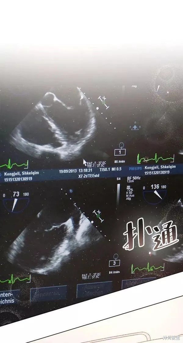 第101话