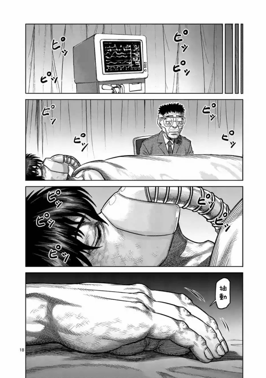 第174话