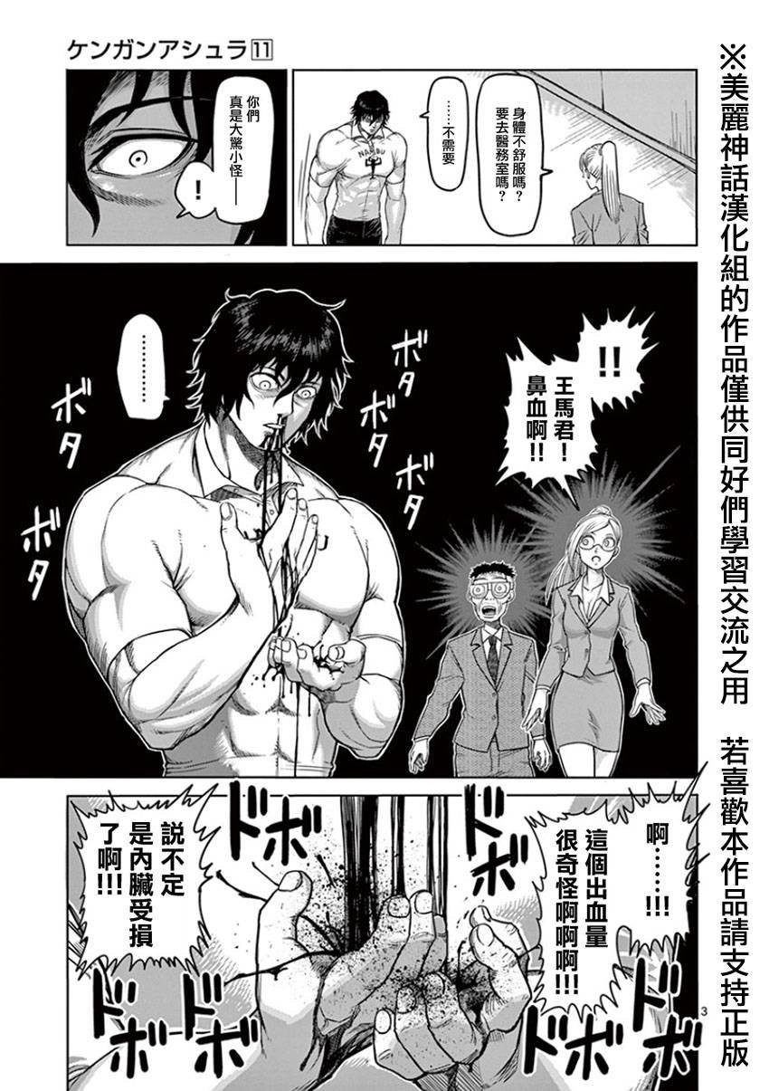 第83话 吐血