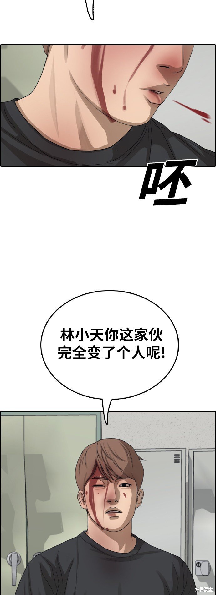 第379话