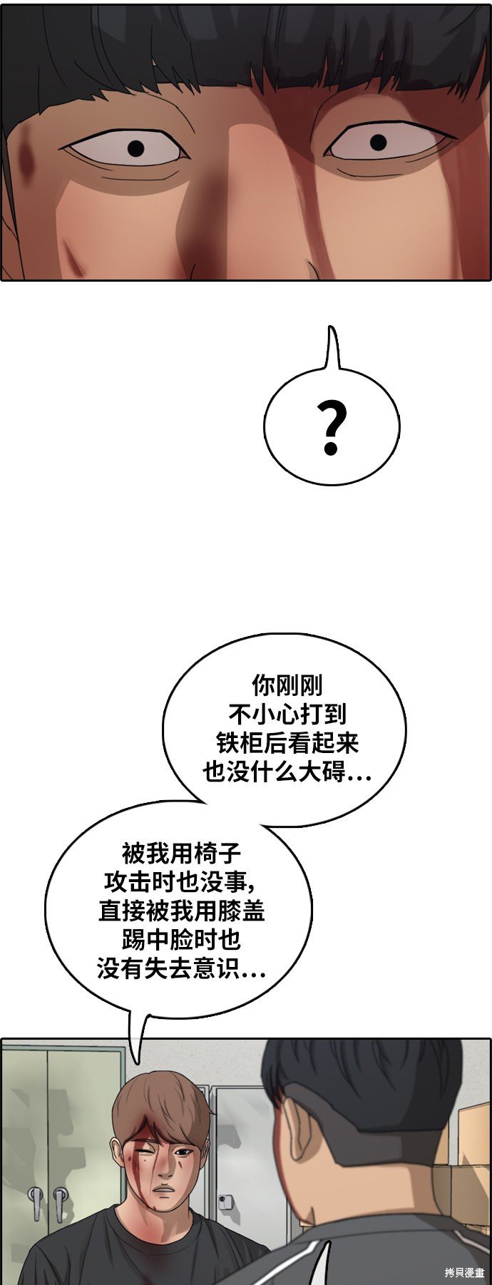 第379话