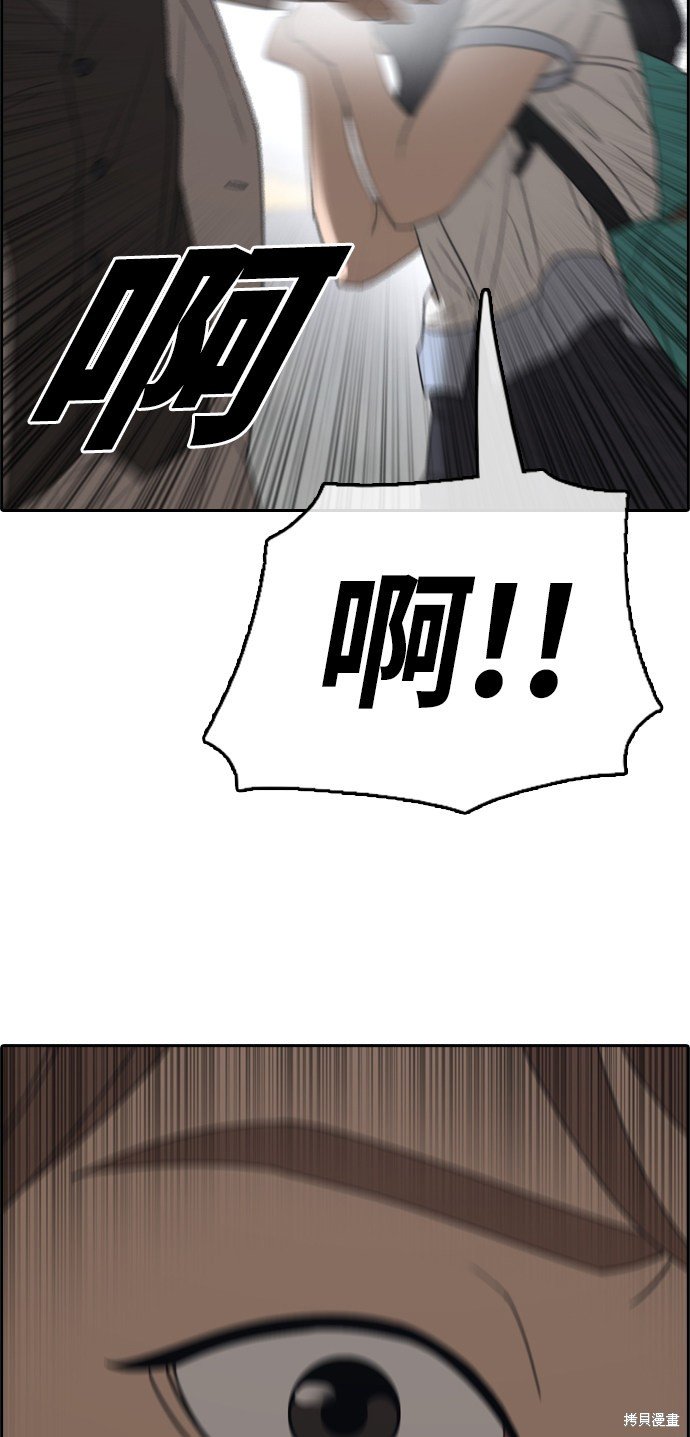 第395话